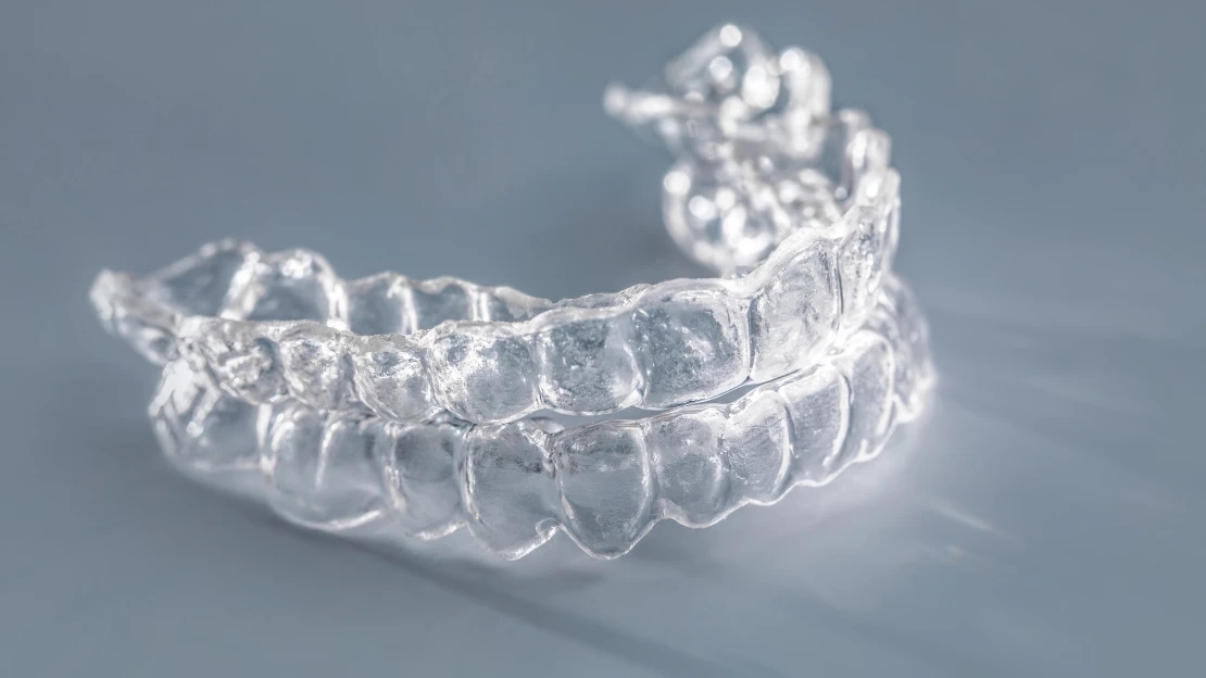 Retainers.png